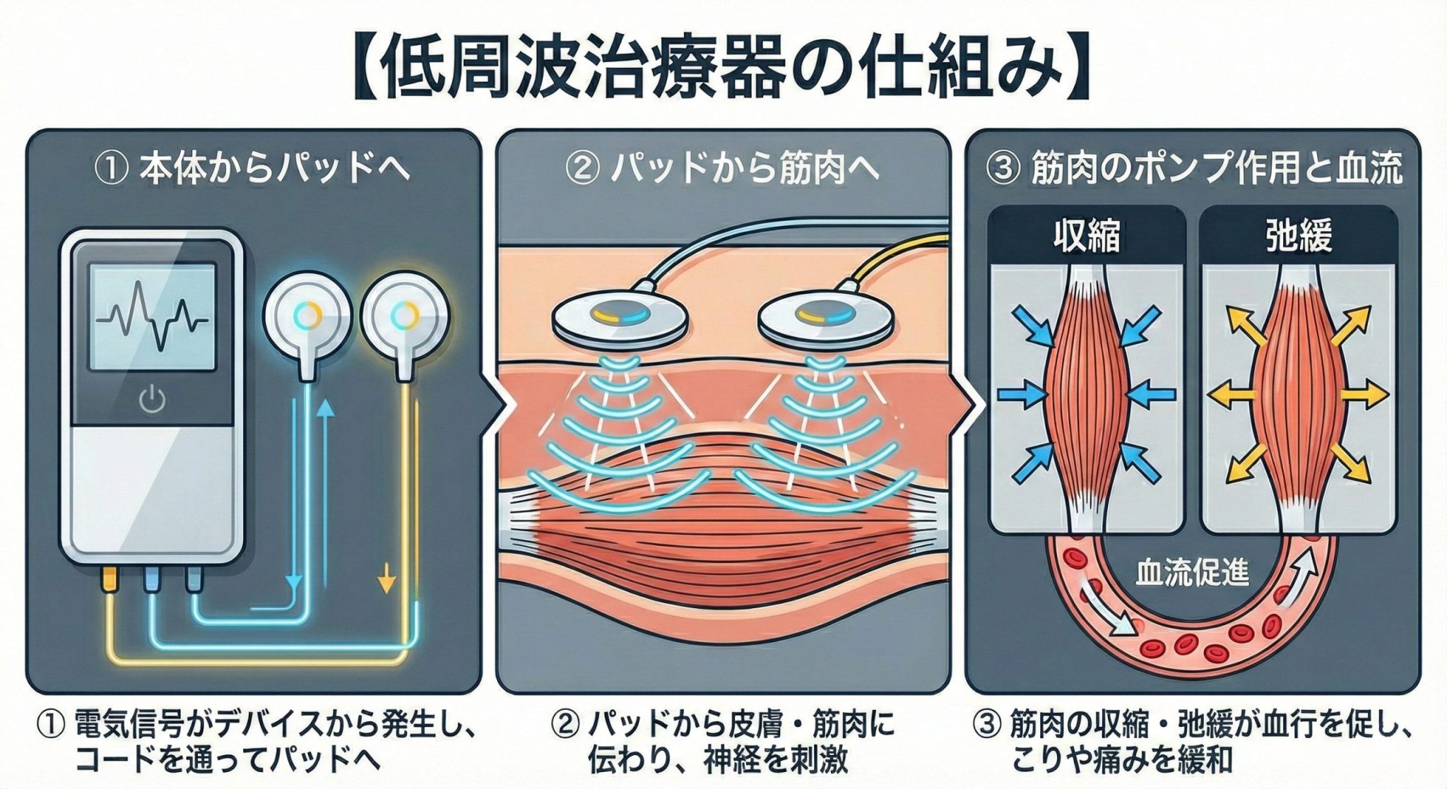 低周波治療器の使い方と選び方|効果・禁忌・部位別のコツ