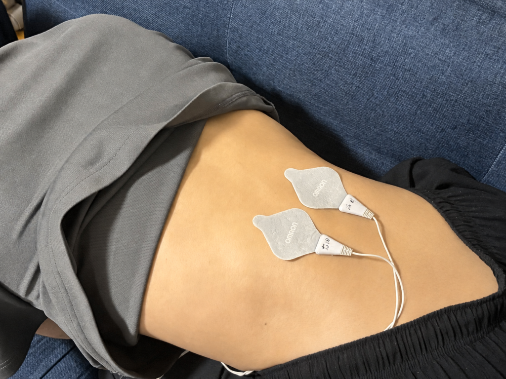 オムロンの粘着パッド2枚を脇腹から腰にかけて貼りつけた状態